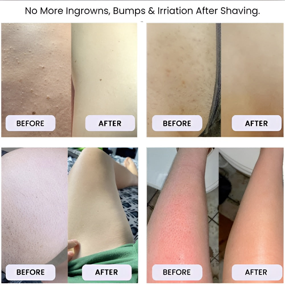 DermEase Razor Pro™